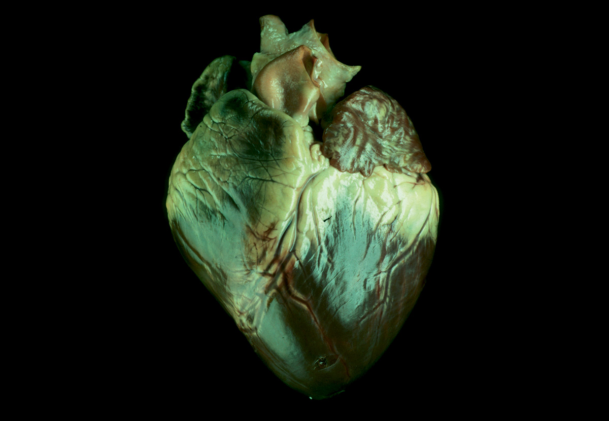 Calisyn Heart Pics