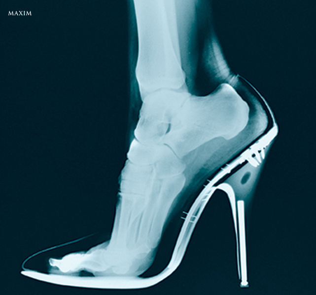 Рентген ноги в туфлях на шпильке