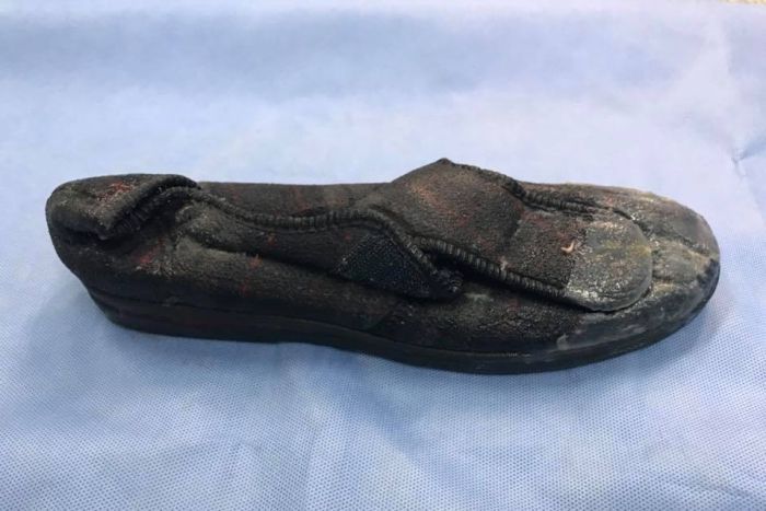 Австралийский пенсионер нашел потерянную тапочку в желудке у гигантской змеи (ФОТО)