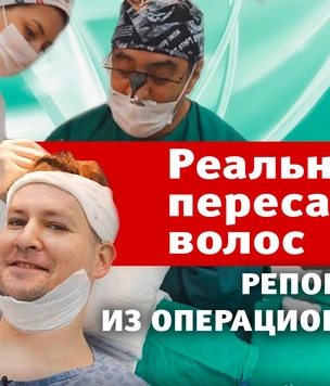 Пересадка волос: наш правдивый видеорепортаж
