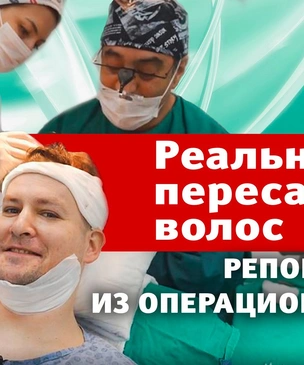 Пересадка волос: наш правдивый видеорепортаж