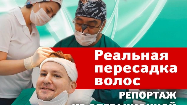 Пересадка волос: наш правдивый видеорепортаж