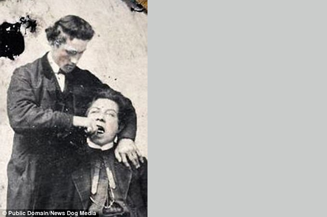 Ужасы викторианской стоматологии: 13 фотографий без анестезии