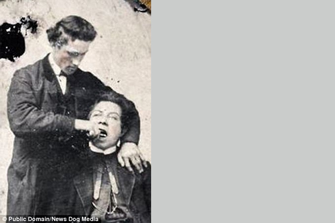 Ужасы викторианской стоматологии! Фотографии, от которых ты спрячешься под стол! Ужасы викторианской стоматологии! Фотографии, от которых ты спрячешься под стол!