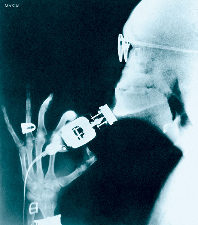 Рентгеновский снимок бритья