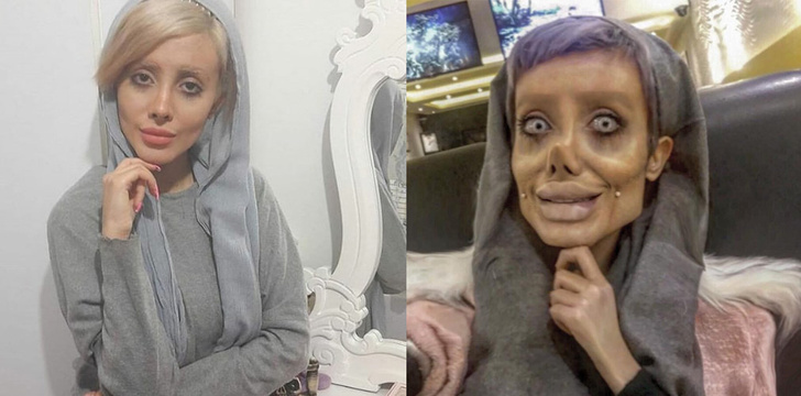 Женщина из Ирана сделала 50 операций, чтобы стать похожей на Анджелину Джоли