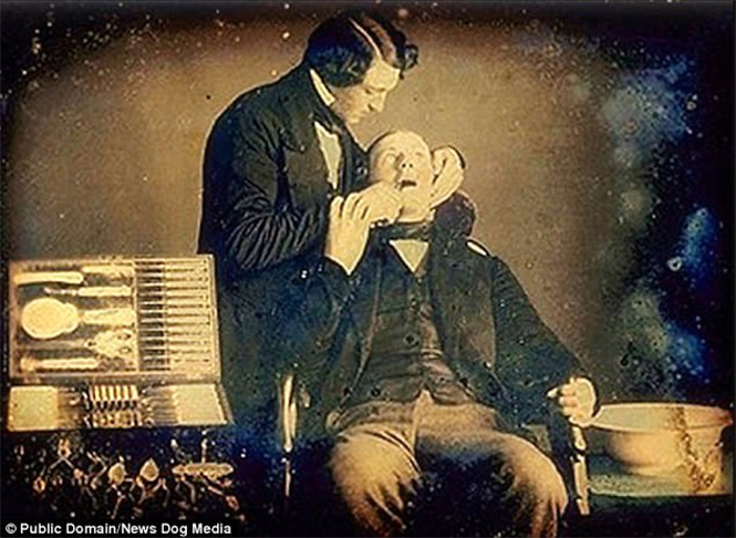 Ужасы викторианской стоматологии: 13 фотографий без анестезии