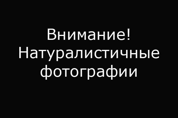 Внимание! Натуралистичные фото Внимание! Натуралистичные фото