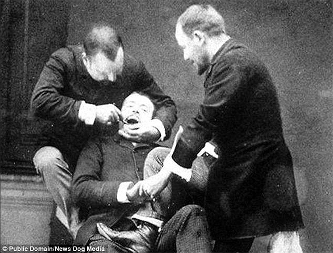Ужасы викторианской стоматологии: 13 фотографий без анестезии