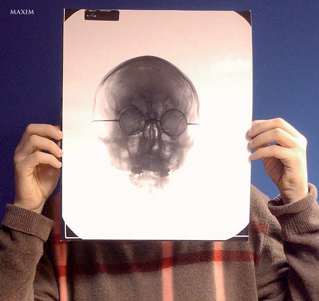 Рентгеновский снимок черепа Джона Леннона