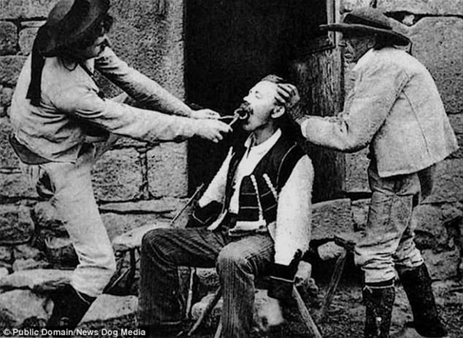 Ужасы викторианской стоматологии: 13 фотографий без анестезии