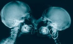 Не дышите! 11 любопытных рентгеновских снимков