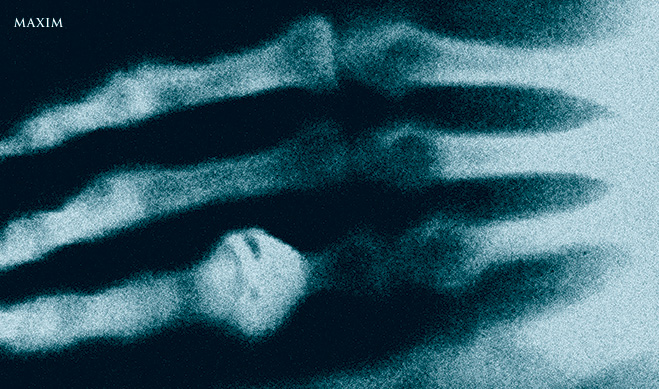 Первый рентгеновский снимок